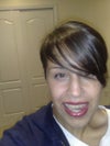 again, full smile with braces, asymmetrical (my) right side.