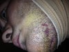 Right next to scar is the mark, it is on the other side, same spot, but smaller with more spaced out dots.