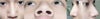 This is my nose in different views.