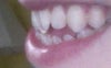 Left side