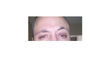 eyebrows not symmitrical