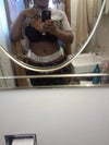 This is 4 days after my tummy tuck