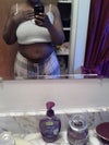 This picture is where I need the belly button revision