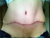 scars & dog ear?