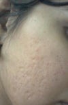 right cheek