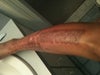 This was 2-hrs after treatment