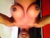 2 day after revision left still higher
