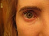 Eyes at rest (no smiling)