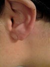 my other ear
