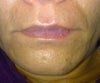 this lips are way too thin for my face! please help..