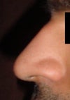Before Side