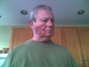One side of my face but it is on both sides