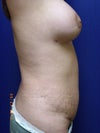 4 1/2 wks