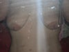 pic of breast