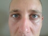 Here's a picture of my tired eyes!