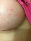 whiteheads?!