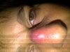 after plastic surgeon cut it open