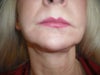 Before surgery thank i looked better not saying much to that