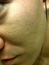 left side. Some icepick and boxscar