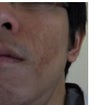 face1