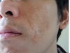 face3