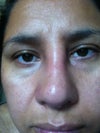 here the picture of the nose