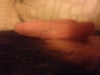 right ear from back (for comparison)
