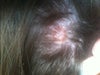 This is a picture of it a couple of weeks ago before I started putting neosporin on it.