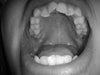 My teeth