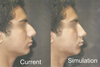 The before and simulated after pic.