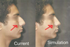 The arrows are pointing to the problem area I am referring to.
