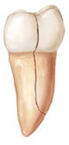 Pic close to my tooth condition.