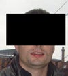 Here is an example of how it looks at it's worst...However if I lean forward a little and a photo is taken closer up the double chin is not visible at all... I wish I could also show a side view photo to give a better indication of the postion of my jaw....