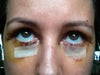 too much white under my right eye
