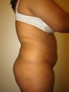 Flat butt, big belly, love handles and flanks
