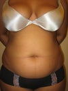 Front belly and thighs