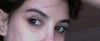 Notice the nodule in the corner of my eye.