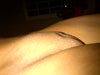 it doesn't really look fatty in person just a dent in that area.