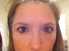 Post Blepharoplasty With out make up