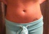 I would like to consider this my " after" photo. I am simply pulling back my flank fat. I would like to know if this expectation is a realistic one, I do not want to be dissapointed after the procedure. Also, which type of liposuction would be the most likely to provide those results?