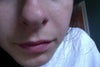 frontal view