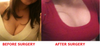 cleavage