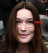 "This is because Botox freezes the middle of the forehead but still allows the use of the frontalis muscle that raises the eyebrows, which is why they appear to slant upwards at an angle. As Carla has always had quite almond-shaped eyes, this has the effect of making her look almost feline."     how can i correct that, please help!