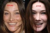 you can see from her younger picture when she raises her eyebrows the corner of the her eyelids wasnt lifted. i want mine to look like that hopefully fillers will do the job by lifting the inner brows up and lower the outer brows