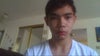 abnormal facial symmetry