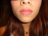 Masseter muscle is bigger on the right side of my face.