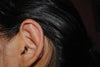 left ear