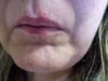 horrible pore!