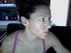 burns and scratches