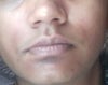 plz see the dark patches